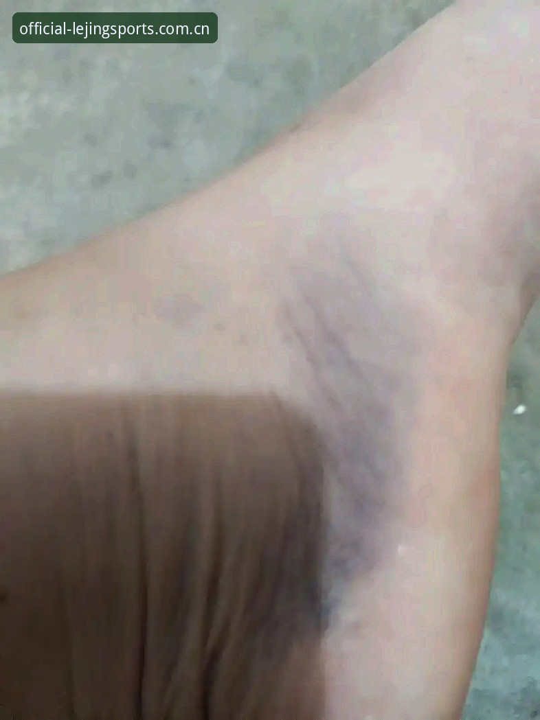 乐竞体育体验 梅里诺康复之路深度分析:从脚伤到欧冠决赛的全面解析